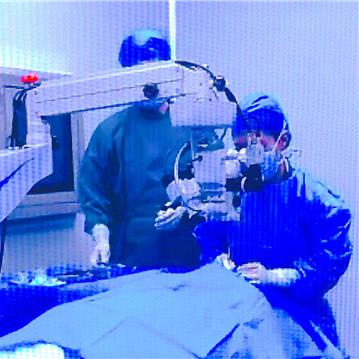 国内ICL晶体V5技术深度解析